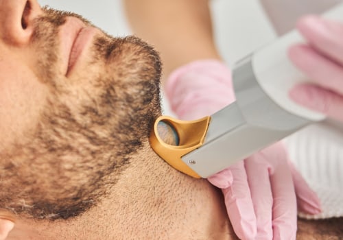 Does insurance cover laser hair removal for chronic ingrown hairs?