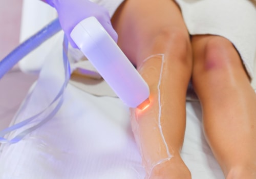 Does laser hair removal work everywhere?