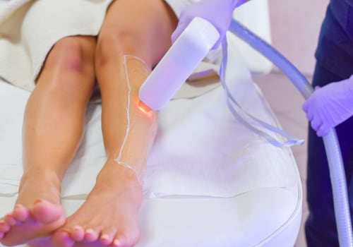 Why Nail Salon Services Are The Perfect Addition To Your Laser Hair Removal Journey In Burnaby