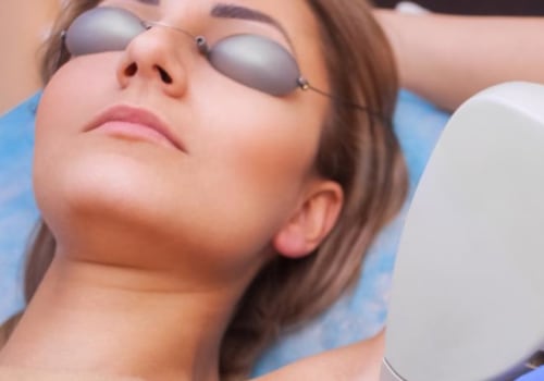 Can laser hair removal be permanent?
