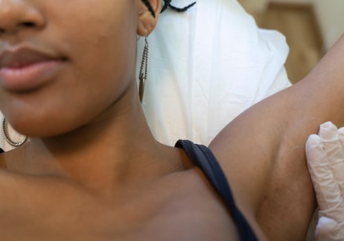 Discover Smooth Skin with Laser Hair Removal in Tampa